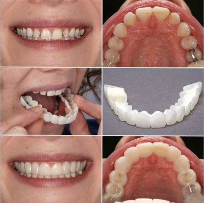 SC™ Smile Fit Flex Teeth Denture