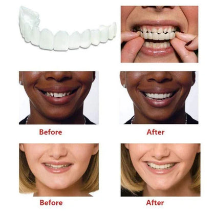 SC™ Smile Fit Flex Teeth Denture